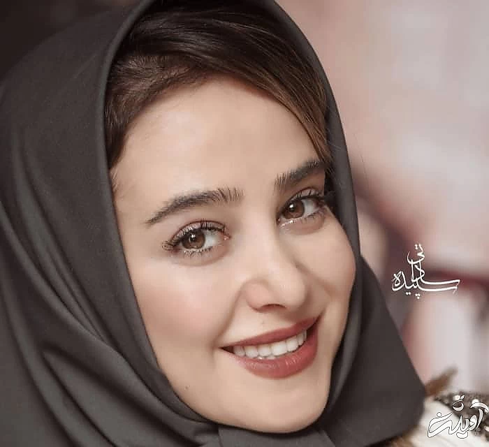 کامپوزیت دندان الناز حبیبی لمینیت